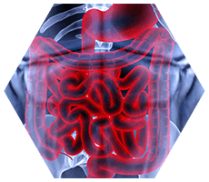 Abdomen X-Ray highlighting Gastro-intestinal System